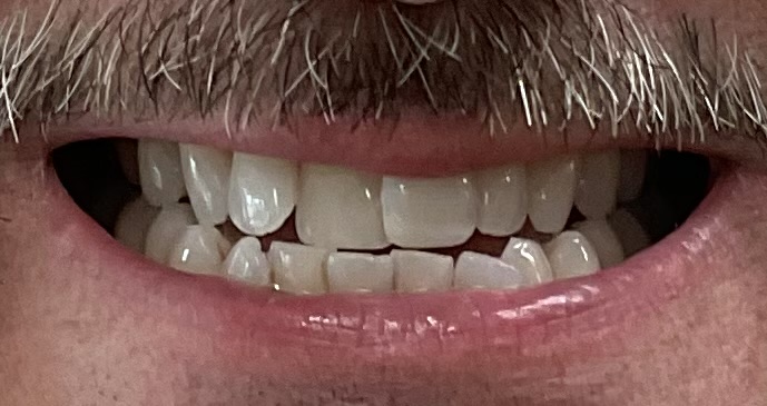 Northwest Villages Dentistry - Vesna Arezina DDS Northwest Villages Dentistry - Vesna Arezina DDS